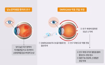 'DWRX2008' 점안 투여시 안구 내 약효 전달 과정