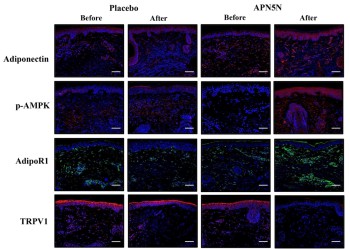 [이미지] APN5N 치료는 TRPV1 발현 감소, 아디포넥틴 및 아디포넥틴 수용체 1 발현 증가 등 우수한 효과를 나타냄.